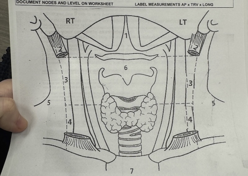 photo of what looks like a coloring book page diagram of the thyroid and surrounding lymph nodes