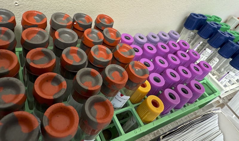 photo of a few dozen empty blood vials with some different caps, on a tray in the room i got blood taken